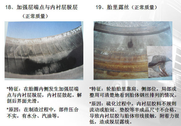 ����ʶ�������̥��������&nbsp;��Ҳ������