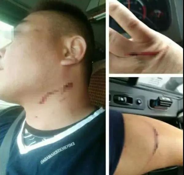 ����˾��Ƶ������ı��󣺲�ƴ��û����