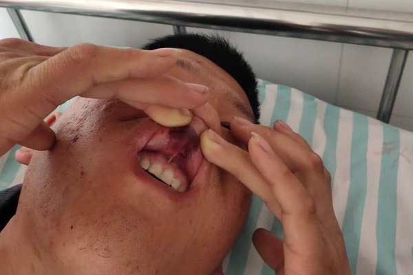 卡家时评:暴力执法何时休 切莫寒了人心