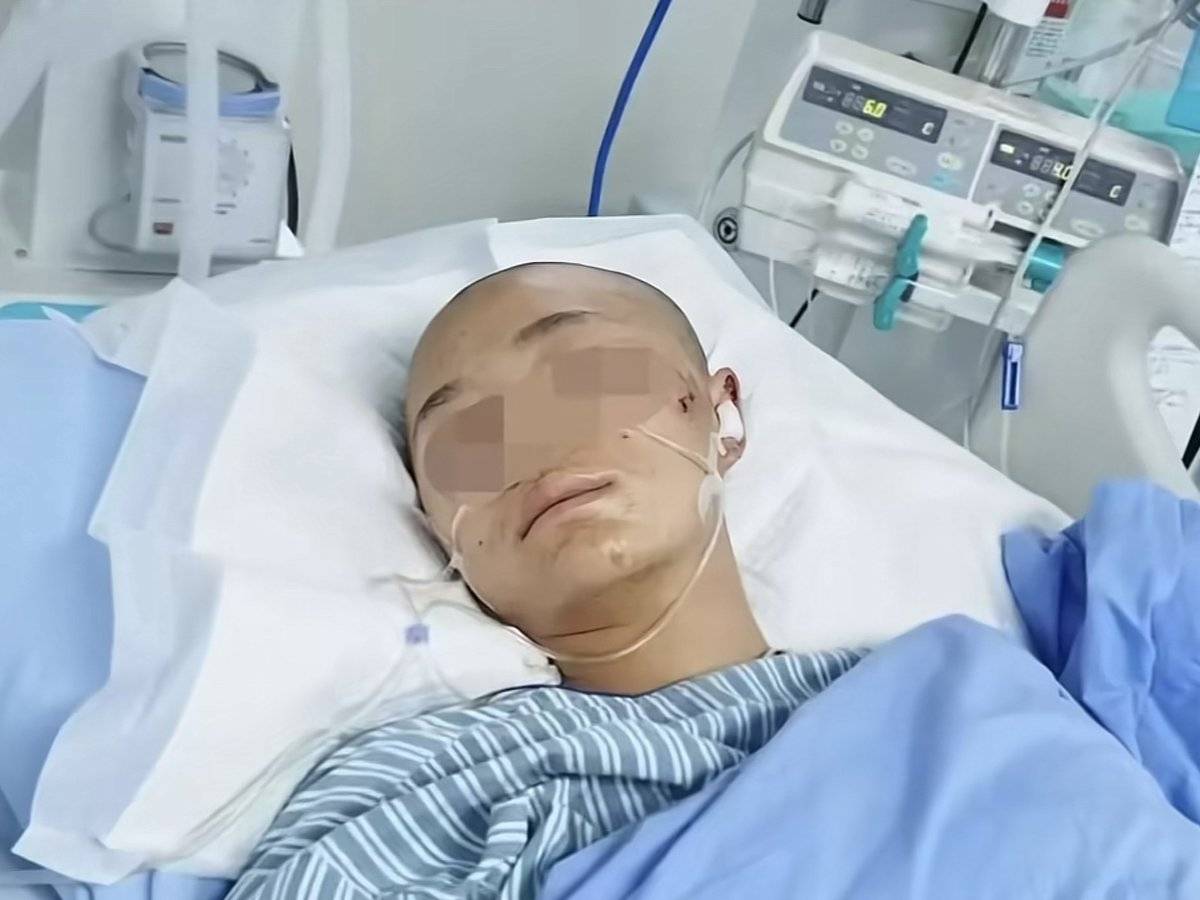 高考前一天遭车祸!女生被货车撞进ICU