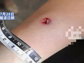 货车司机无聊向路人发射钢珠 司机：想找点乐子没想到威力这么大