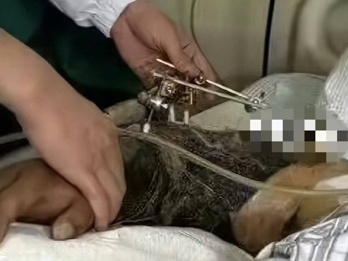 男子胳膊放窗外 被货车挤压仅断成三截